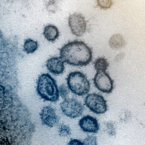 Imagen De Microscopio Electrónico SARS-CoV-2