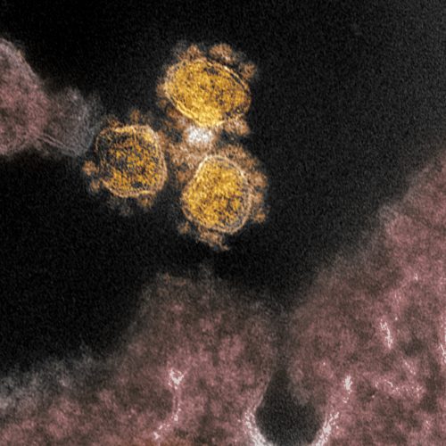 Partículas De Virus COVID-19