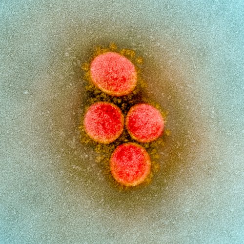 Micrografía Electrónica Virus SARS-CoV-2
