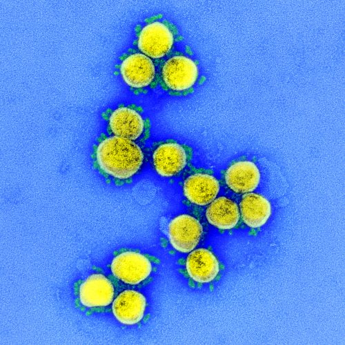 Particulas Del Virus SARS-CoV-2, Aislada De Un Paciente